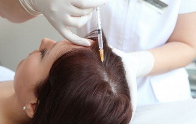 Mezoterapia în tratamentul alopeciei feminine