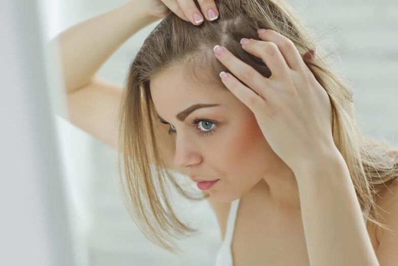 O fată examinează focarele de alopecie