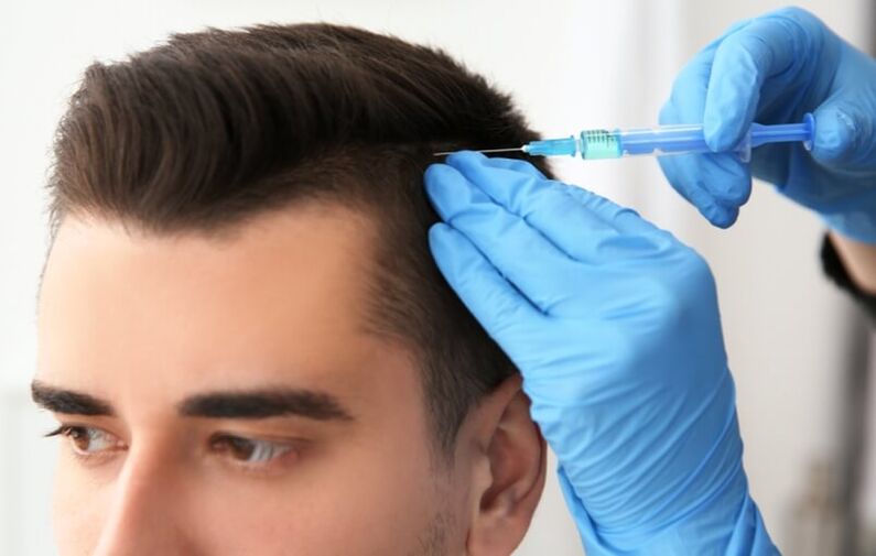 Mezoterapia pentru stimularea creșterii părului în alopecia androgenă